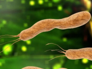 ��˯֢����ô���� ��˯֢������ƫ��