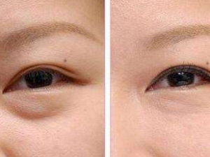 ʹ����˪����������Щ ��˪����ȷʹ�÷���