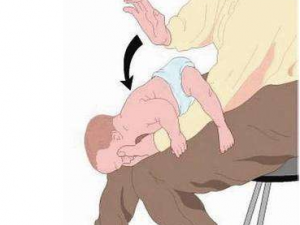 С��ҭʳ֢״ С��ҭʳ���Ӧ��