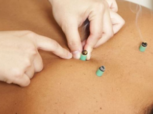 �ŵװλ�޵�ע������ �ŵװλ����ʲô�ô�