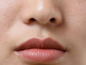 ��Ѫ˿���ð״�ϴ���� �����к�Ѫ˿����ô����Ƥ����