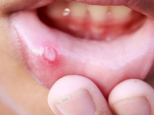 �������������촽 ���커���ķ���