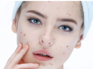 ��ô���Ƥ�� ����ҲҪ�������