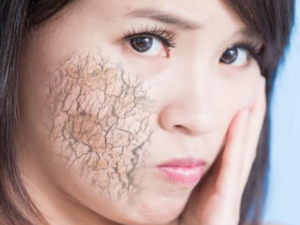 Ƥ��ȱˮ��μ�ʱ��ˮ Ƥ��ȱˮ��֢״��ʲô