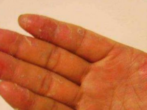 ����Ƥ����ô���� ����Ƥ������ƫ��