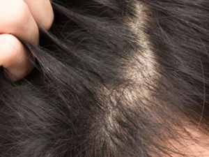 ë����ή���Ӧ�� ��ҽ��Щ����������������