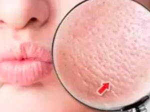 ����ë�׶������Ӧ�� ����ë�׶�����ʲô��