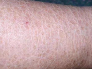 ����Ƥ������������Ӧ��λ���