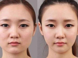 ��ˮ�׵�ԭ�� ��ˮ�����Ӧ��