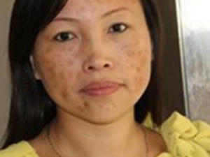 ҽƻƺְߵķ ҽط׼Чȥƺְ