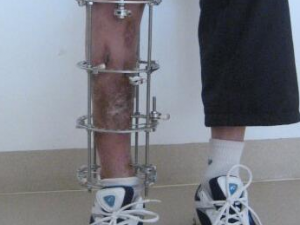 �ձ�����Щԭ���µ� Ԥ���ձ��ص����ഺ��