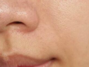 ��ҽ���ҽ�κ�ͷ ��������������Ч�����ͷ����