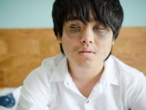 ��ð���ҳԿ����� ��ð��������Щ������