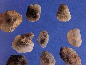 ����ʯ����Щ��Ч ����ʯ��ͷ����ʹ