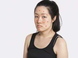 ����ʪ���ضԼ�����Ӱ�� ��ʪ����Ԥ���������Ĳ���