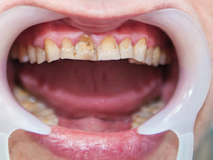 ����ڳ���ʲôƫ�� ��α��ֿ�ǻ����