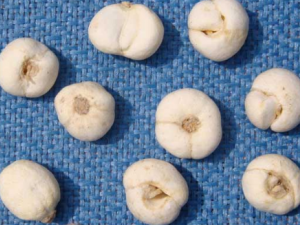 ����ϸ��ɢ�Ĺ�Ч ����ϸ��ɢ���εӳ�����