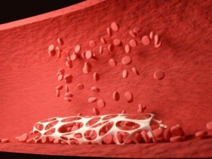 �ɶ��������ҵĹ�Ч�����ÿ��գ�������֬���룡