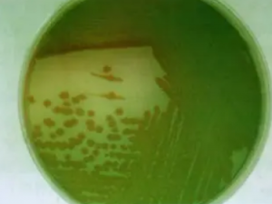 ͭ��ɢ�Ĺ�Ч ͭ��ɢ�����Ӹ�������ʪ�ʹ�