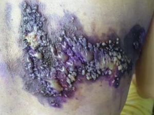 ��״�������ʳ���� ��״��������Щ֢״