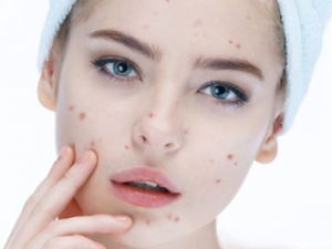 ������α���Ƥ�� ��������Ƥ���ķ���