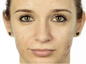 ������ƬҲ�������� ������Ƭ�ɱ�ʪ�����Ȧ