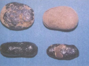 �����ӵĹ�Ч ����������ҭ����θ