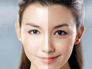 ��Щʳ���Ƥ������ ��ҪƤ����Ӧ�����ʳ