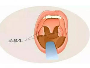 �����巢����ô�� ���Ʊ����巢�׵�ƫ��