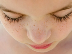 ������������׵�Ƥ���������Ӧ��