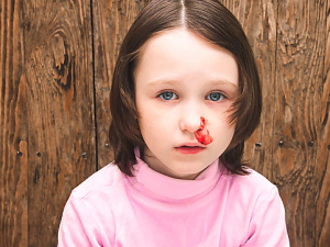 ��ǻ�ڳ�Ѫ�Ժ�Ҫ��δ��� ���Ӿ�����Ѫ������