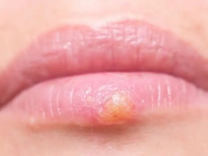 ����ɢ�Ĺ�Ч ����ɢ��ʪ�Ȳ�ȥ