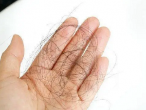 �����ѷ���ô�� ��Щ��ҩ����Ԥ���ѷ�