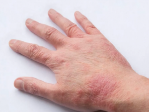 ʪ�����ô�� ��������ʪ�����ҽСƫ��