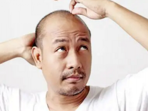 �����ѷ�����Щԭ�� Ԥ���ѷ��ķ�������Щ