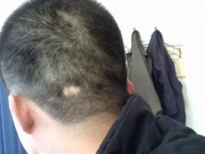 ��ͺ���������Ա� ��ô��ҽ��������ư�ͺ��