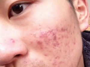 ��ҽ��������ݵ� ����������ҽ���ݵ�С����