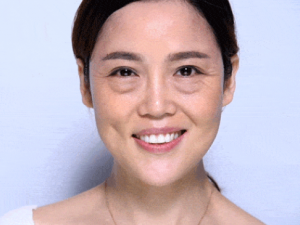 �۴�̫����ô�� ��ҽ���������۴��İ취