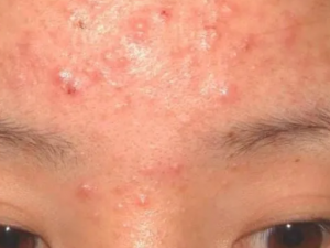 ���ƶ������г�ҩ����Щ ��֪����