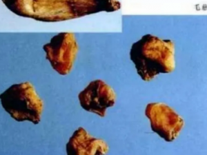 ѹ��������ϻ��� ��β��ܻ�����