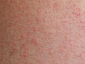 ������˲��ܳ�ʲôʳ�� ������˵���ʳ����