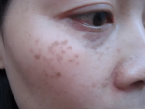 ��������ʲô���� ������Ӧ��������