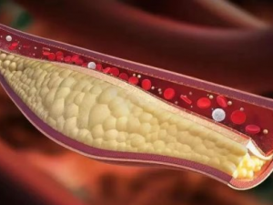 ������������ĸо��ǰ�ʾѪ�ܶ�����