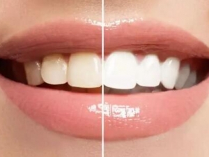 �������ݻ�����������Щ�˺�