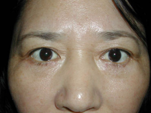 Ƥ���ֲڸ����������� Ƥ���ֲڳ�ʲô������