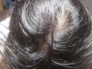 ͷ������������ô�� ͷ������������ô����