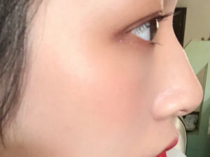 ������֬������ô���� ȥ��֬��������