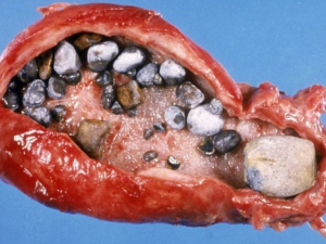 ��η�ֹ���ҳ���ʯ ����ʯ������Ƭ�ǵû�