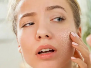 Ƥ��������ԭ�� Ƥ��������λ�������