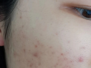 ʲôܹȥӡ ⶻӡķƼ